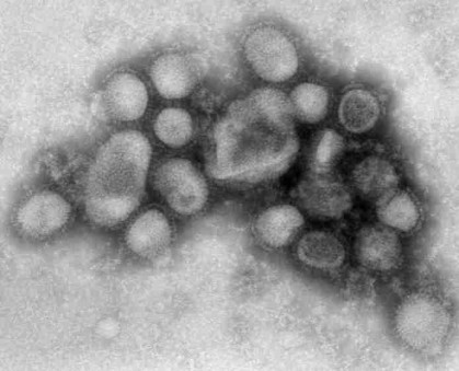 virus de gripe A H1N1